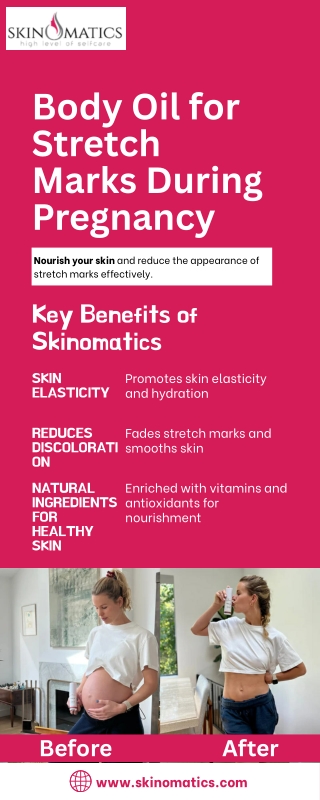 Body Oil for Stretch Marks During Pregnancy