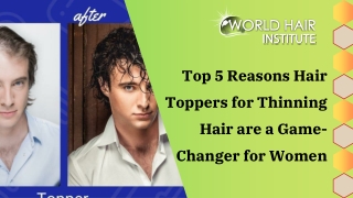 Top 5 Reasons Hair Toppers for Thinning Hair are a Game-Changer for Women