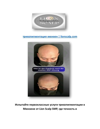 трихопигментация мюнхен | lionscalp.com