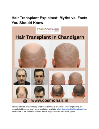 Hair Transplant Explained: Myths vs. Facts You Should Know