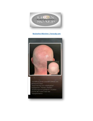 Neuharline München | lionscalp.com