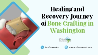 Healing and Recovery Journey of Bone Grafting in Washington