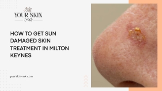 How to Get Sun Damaged Skin Treatment in Milton Keynes