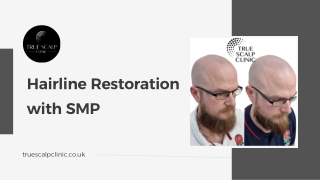 Hairline Restoration with SMP