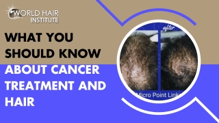 What You Should Know about Cancer Treatment and Hair