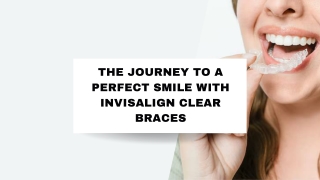 The Journey to a Perfect Smile with Invisalign Clear Braces
