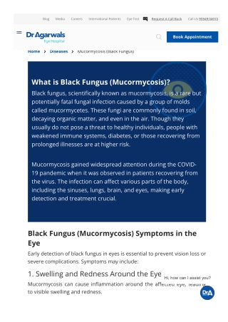 www-dragarwal-com-diseases-conditions-black-fungus-...