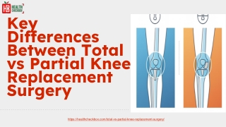 Key Differences Between Total vs Partial Knee Replacement Surgery PPT 1