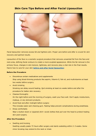 Skin Care Tips Before and After Facial Liposuction