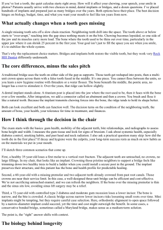 Dental Implants or Bridges? A Dentist’s Perspective on Tooth Replacement