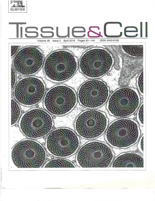 The role of curcumin in streptozotocin-induced hepatic damage and the trans-differentiation of hepatic stellate cells