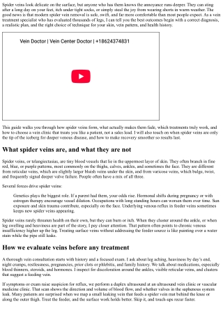 Spider Vein Removal 101: Safe and Effective Methods