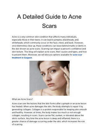 A Detailed Guide to Acne Scars