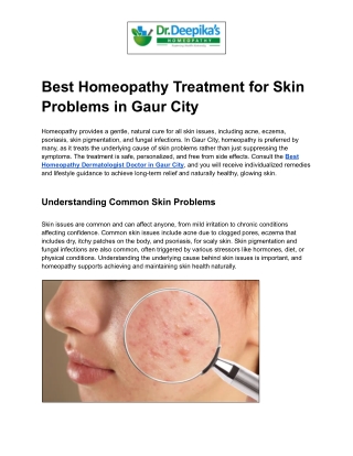 Best Homeopathy Treatment for Skin Problems in Gaur City