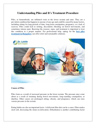 Understanding Piles and It’s Treatment Procedure