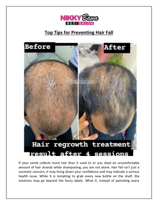 Top Tips for Preventing Hair Fall