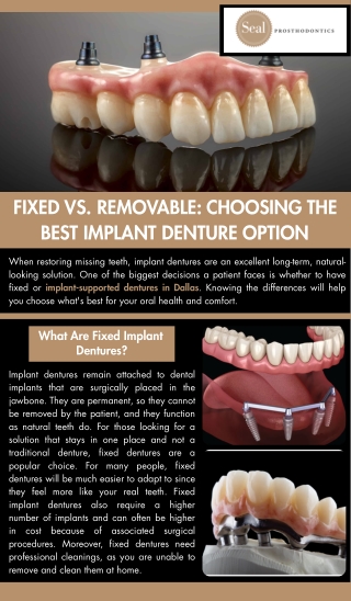 Fixed vs. Removable: Choosing the Best Implant Denture Option