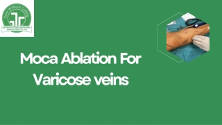 Best Hospital for Varicose Vein Treatment in India – Advanced Care for Lasting R