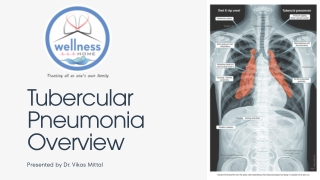 TB & Chest Infection Doctor in Delhi - Tubercular Pneumonia Care.