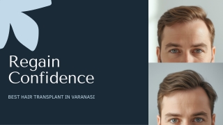 Regain Confidence with the Best Hair Transplant in Varanasi