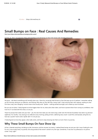 How I Finally Reduced Small Bumps on Face Without Harsh Products