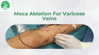 Effective Varicose Veins Treatment in India – Advanced & Painless Solutions