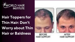 Hair Toppers for Thin Hair Don't Worry about Thin Hair or Baldness
