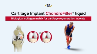 Cartilage Implant ChondroFiller® liquid