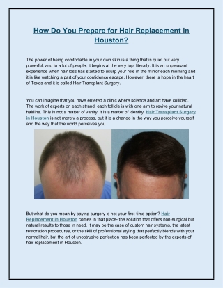 How Do You Prepare for Hair Replacement in Houston