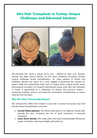 Afro Hair Transplants in Turkey Unique Challenges and Advanced Solutions
