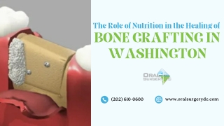 The Role of Nutrition in the Healing of Bone Grafting in Washington