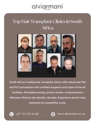 Top Hair Transplant Clinics in South Africa