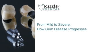 Essential Insights into Gum Disease Stages and Effective Prevention