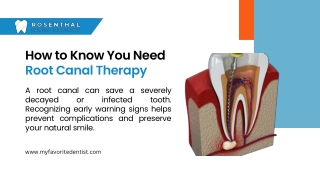 How to Know You Need Root Canal Therapy