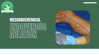 Understanding Varicose Veins Treatment Cost in India: What You Need to Know