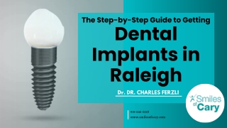 The Step-by-Step Guide to Getting Dental Implants in Raleigh