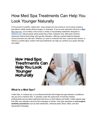 How Med Spa Treatments Can Help You Look Younger Naturally