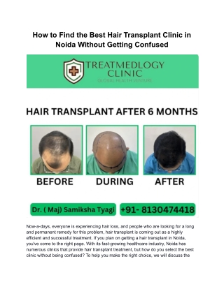 How to Find the Best Hair Transplant Clinic in Noida Without Getting Confused