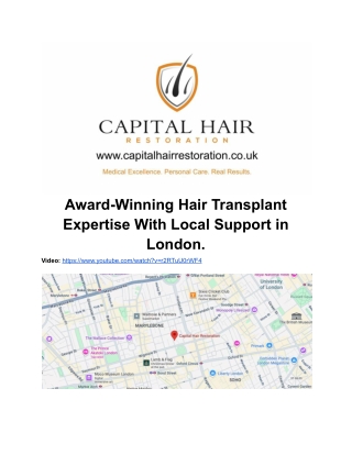 Hair Transplant Central London West London South London East London and North London