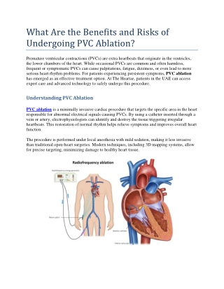 What Are the Benefits and Risks of Undergoing PVC Ablation