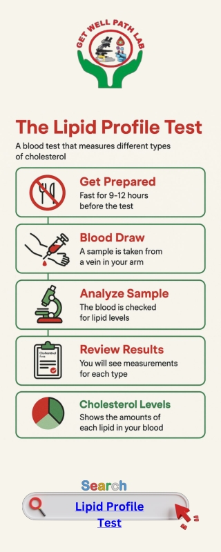 Lipid Profile Test (LPT)