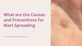 What are the Causes and Preventions for Wart Spreading