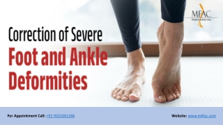 Correction of Severe Foot and Ankle Deformities