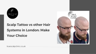 Scalp Tattoo vs other Hair Systems in London Make Your Choice