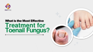 Best Treatment for Toenail Fungus That Actually Works