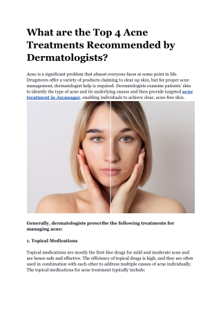 What are the top 4 acne treatments recommended by dermatologists