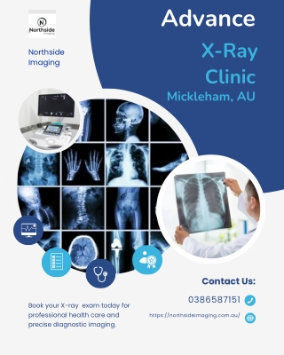 X-ray Mickleham