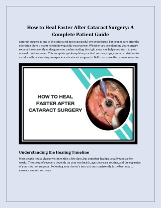 How to Heal Faster After Cataract Surgery_ A Complete Patient Guide