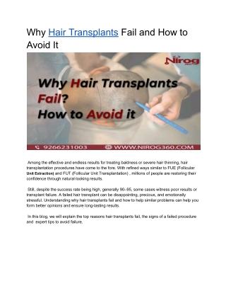 Why Hair Transplants Fail and How to Avoid It