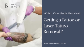 Which One Hurts the Most: Getting a Tattoo or Laser Tattoo Removal?
